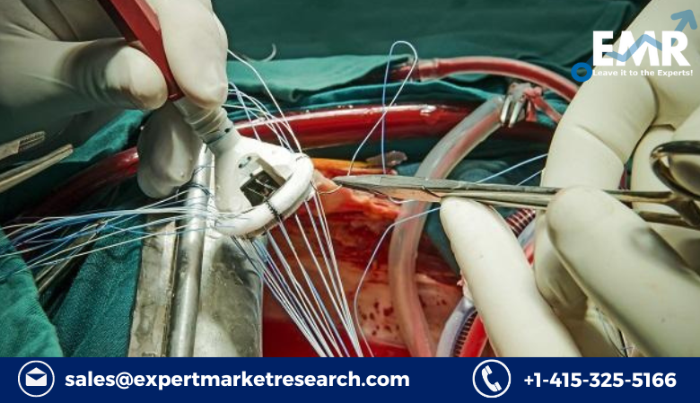 Aortic Valve Replacement Devices Market Size