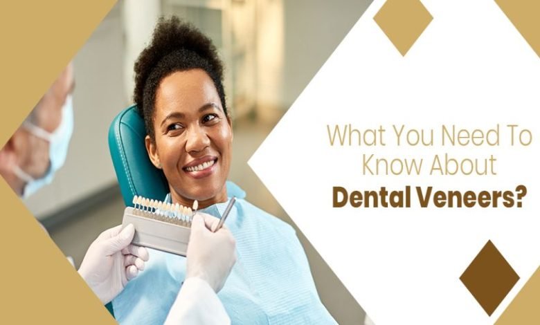 What You Need To Know About Dental Veneers