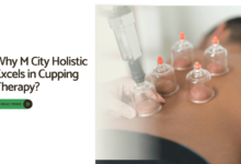 cupping therapy