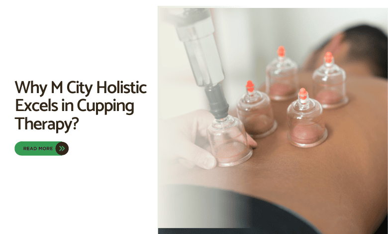 cupping therapy