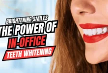 In-Office Teeth Whitening