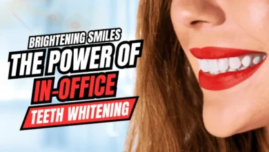 In-Office Teeth Whitening