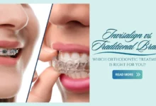 Invisalign vs. Traditional Braces