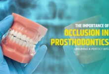 Occlusion in Prosthodontics