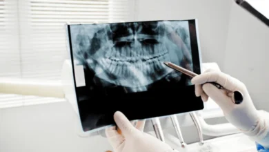 Dental X-Rays