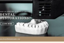 3D printing in dental restorations