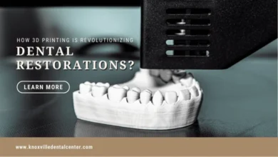 3D printing in dental restorations