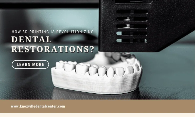 3D printing in dental restorations