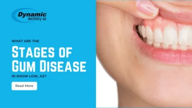 stages of gum disease