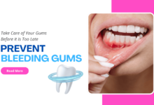 prevent bleeding gums