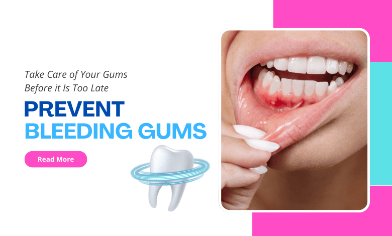 prevent bleeding gums