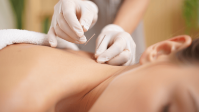 Licensed practitioner performing acupuncture on a patient’s upper back using sterile needles in a clinical wellness setting.